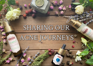 Sharing Our Acne Journeys